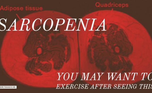 CÁCH CHỐNG LẠI CHỨNG SARCOPENIA - MẤT CƠ DO LÃO HÓA